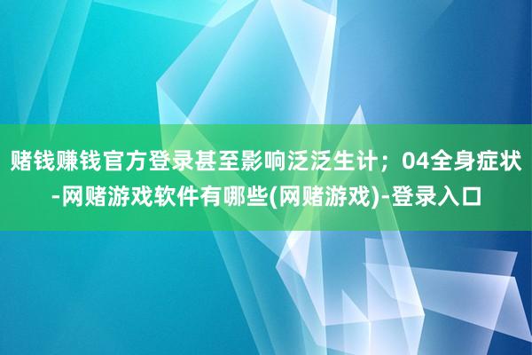 赌钱赚钱官方登录甚至影响泛泛生计；04全身症状-网赌游戏软件有哪些(网赌游戏)-登录入口